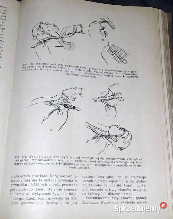 Intensywna terapia W Jurczyk Z Rondio Chełm