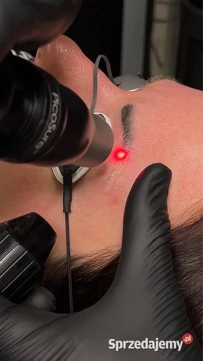 Usuwanie makijażu permanentnego Pozostałe