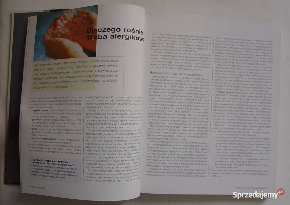 ALERGIA zrozumieć rozpoznawać leczyć alergie i Poradniki, albumy i reportaże Łódź sprzedam