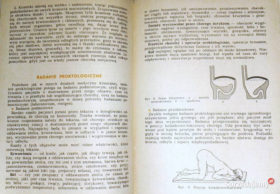 Hemoroidy a choroby proktologiczne Mieczysław miękka Chełm