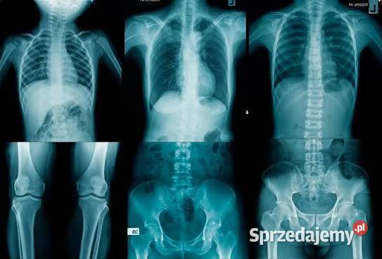 Klisze RTG każda ilość Jeżów Sudecki