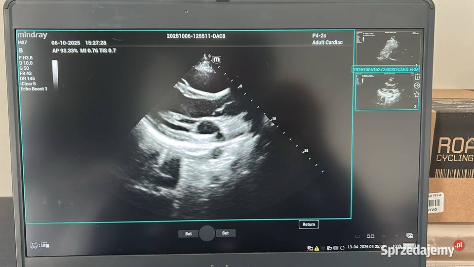 Aparat USG Mindray MX7 2021r pomorskie Gdańsk