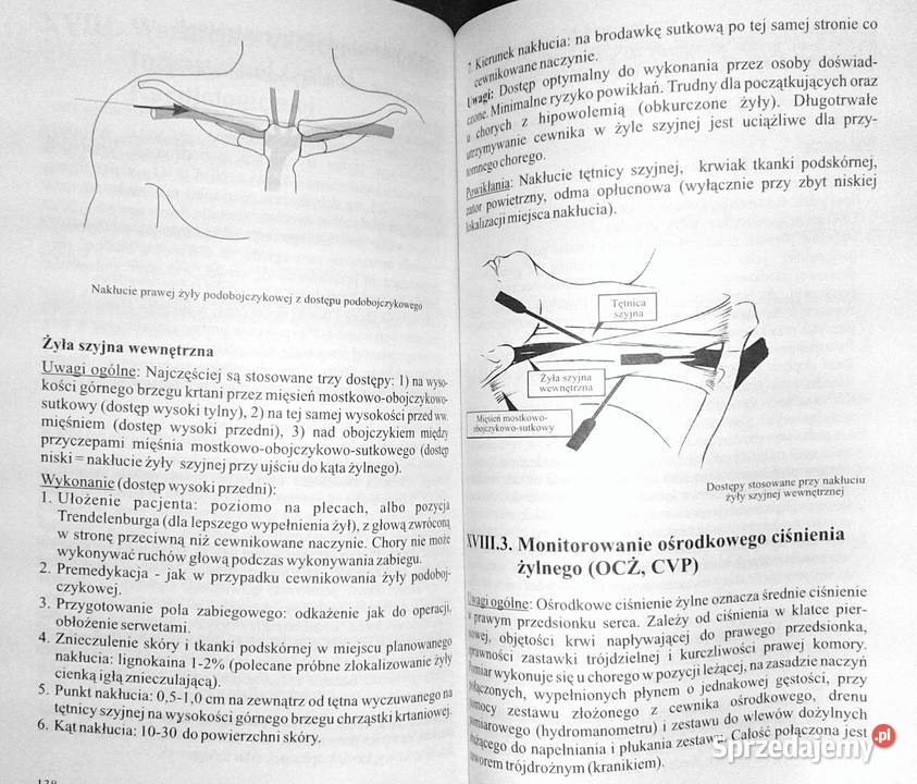 Ostre stany kardiologiczne Algorytmy lubelskie
