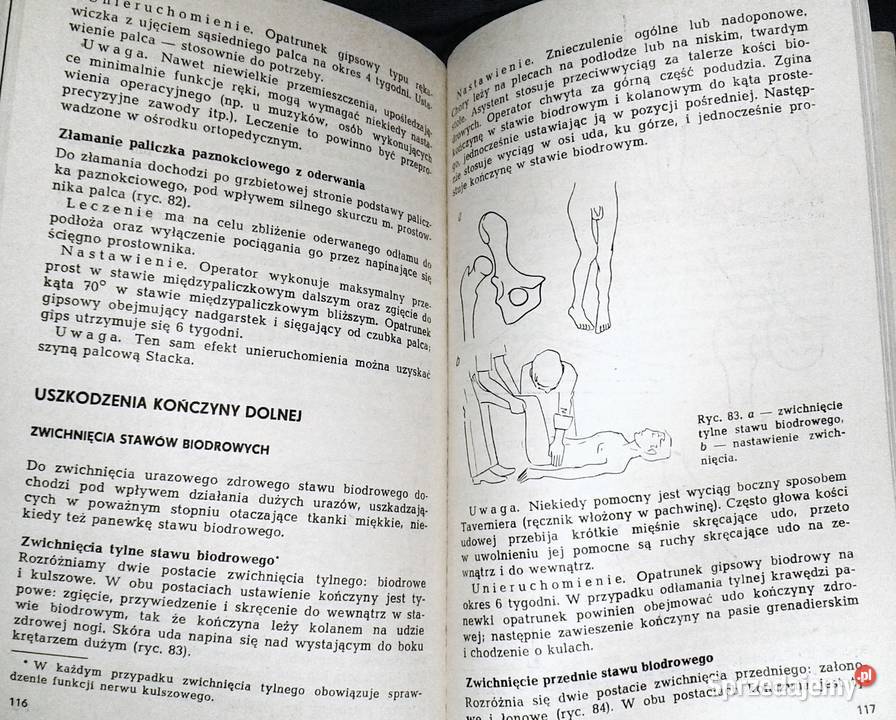 Zasady leczenia złamań i urazów kończyn Bogdan Rok wydania 1978 Chełm