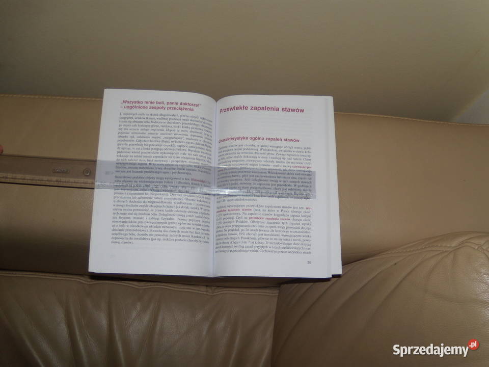 Reumatyzm Mały leksykon medyczny