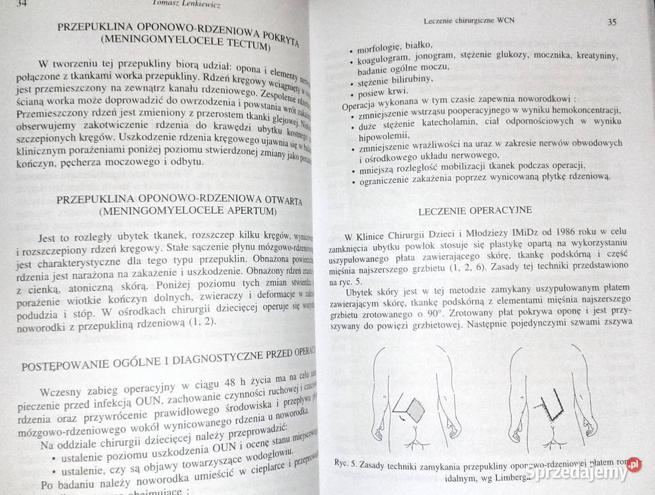 Zapobieganie wrodzonym wadom cewy nerwowej Z Chełm sprzedam