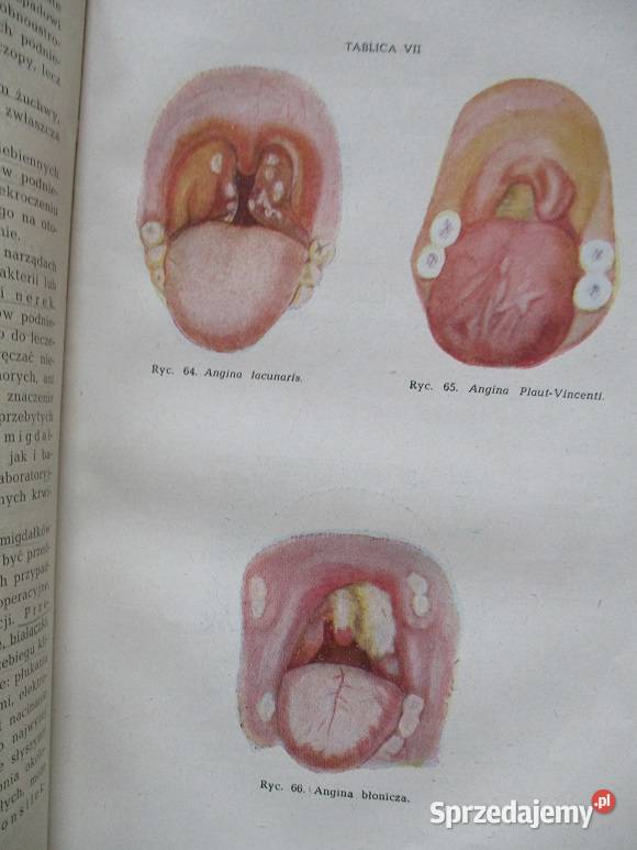 Choroby jamy ustnej gardła nosa krtani i medycyna, nauki medyczne Książki naukowe i popularnonaukowe