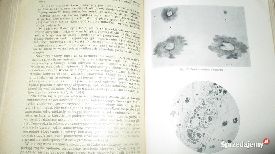 Choroby wewnętrznered H Dennig Berger medycyna Książki naukowe i popularnonaukowe