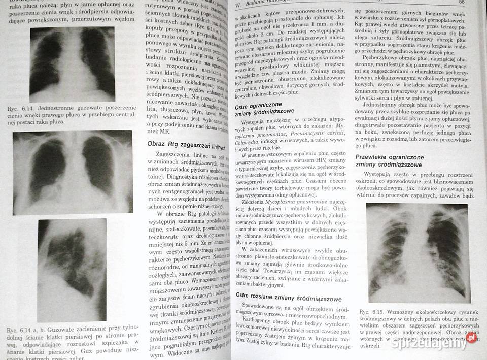 Pneumonologia i alergologia praktyczna Ryszarda miękka Chełm
