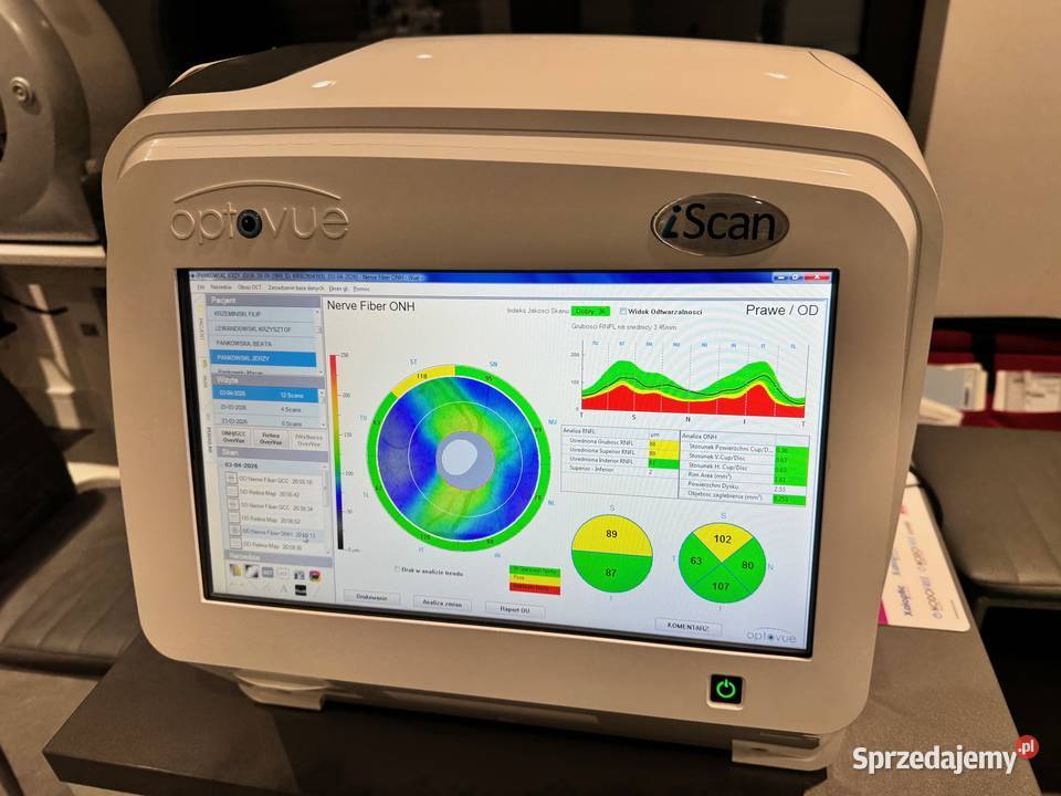 OCT tomograf okulistyczny OPTOVUE ISCAN wielkopolskie