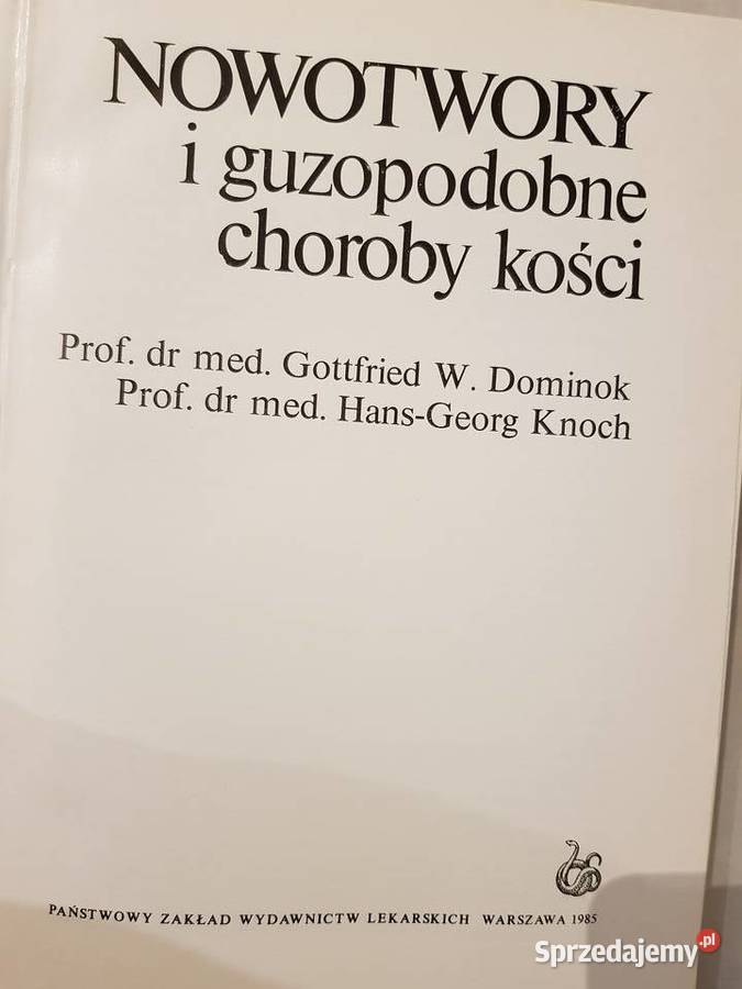 Nowotwory i guzopodobne choroby kości Dominok Kielce