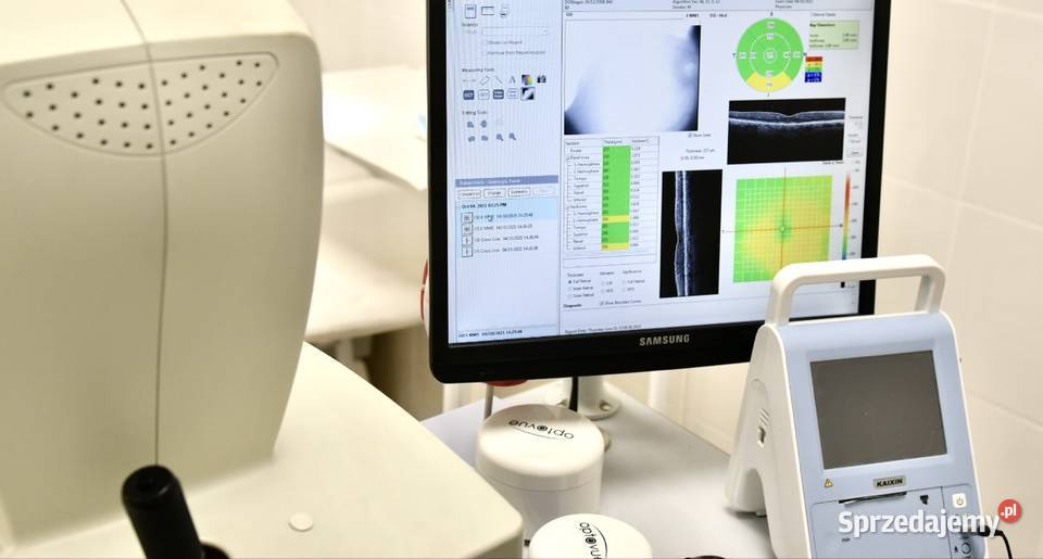 Oct Soct tomograf okulistyczny Łódź sprzedam