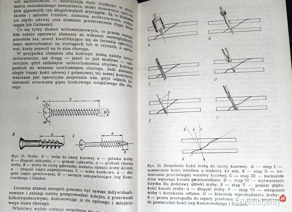 Zasady leczenia złamań i urazów kończyn Bogdan miękka Chełm