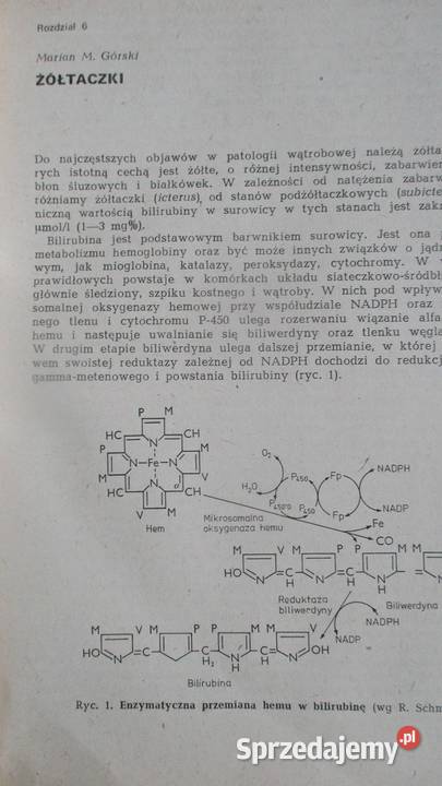 Choroby wątroby i dróg żółciowych Brzozowski medycyna, nauki medyczne Łódź