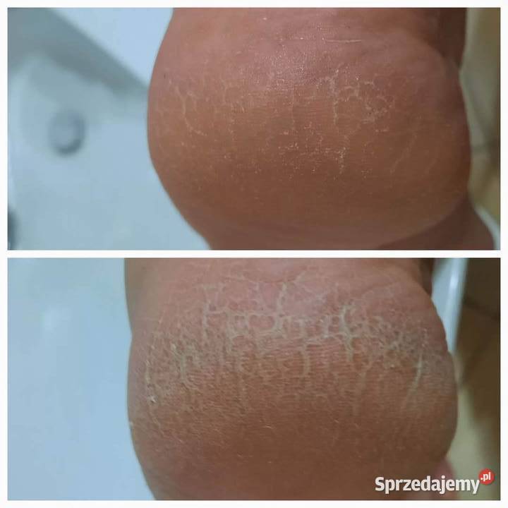 Zmiękczający krem do stóp 75ml Mihi Kosmetyki Hajnówka