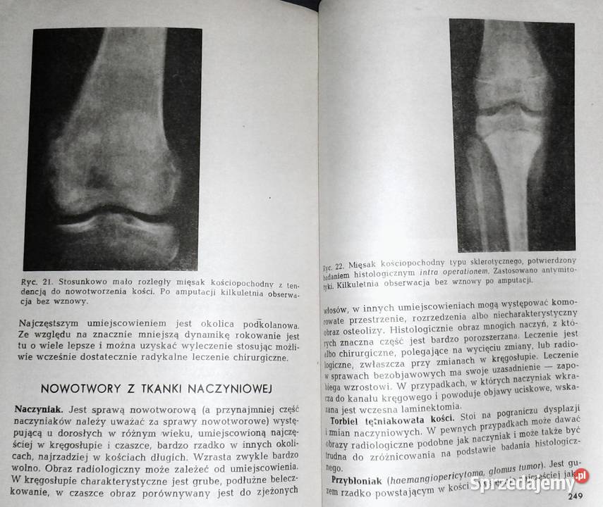 Onkologia Seria II Tom 5 Anna Madejczyk Chełm