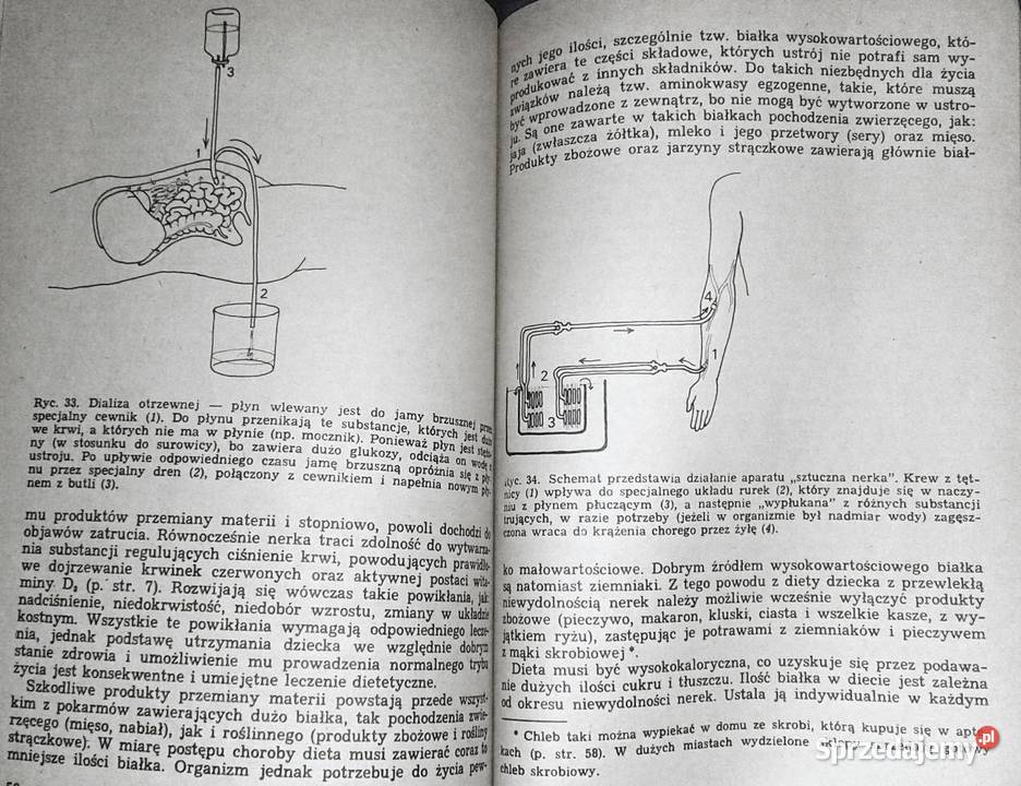 Choroby nerek u dzieci Teresa Wyszyńska Pozostałe lubelskie Chełm