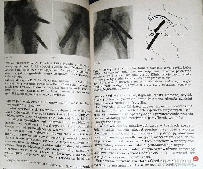 Niepowodzenia w leczeniu uszkodzeń narządów Pozostałe sprzedam