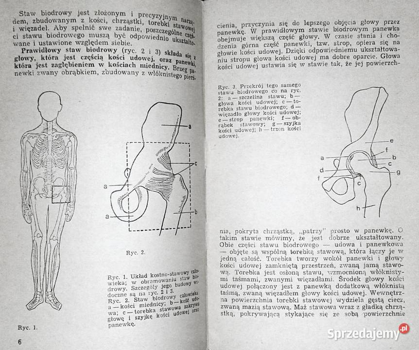 Wrodzone zwichnięcie biodra jest uleczalne Karol sprzedam