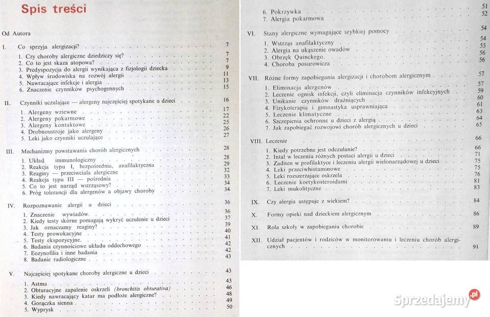 Alergia u dzieci Danuta ChmielewskaSzewczyk