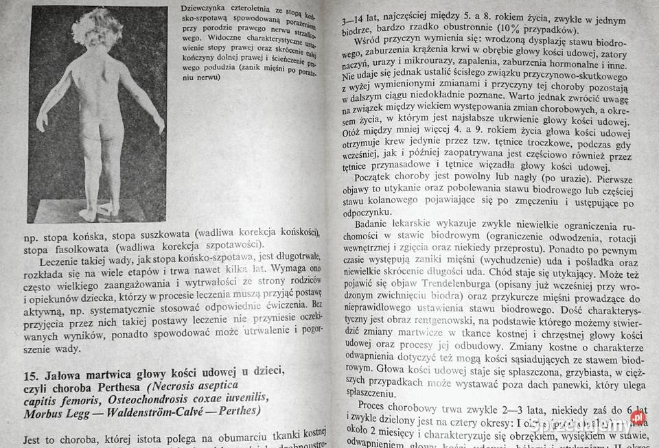 Dziecko kalekie jakiego nie znamy Barbara Rok wydania 1989 Chełm sprzedam