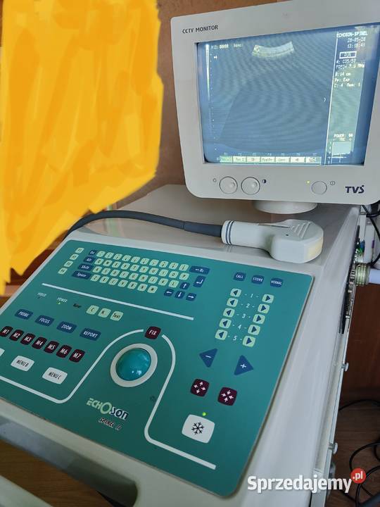 Ultrasonograf USG echoson spinel 2