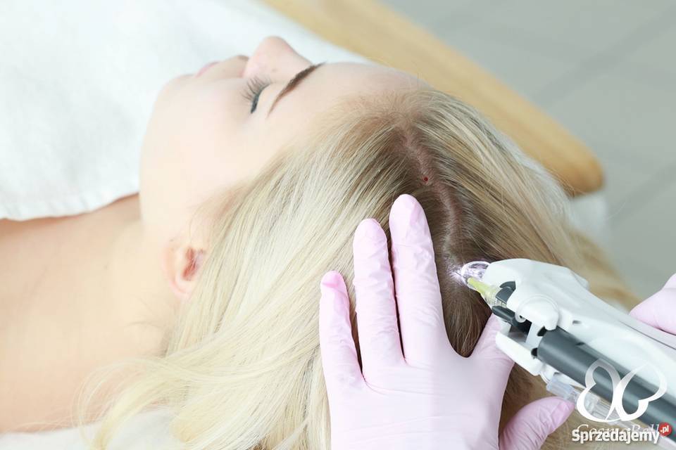 Karboksyterapia CosmoBelle Clinic Tychy