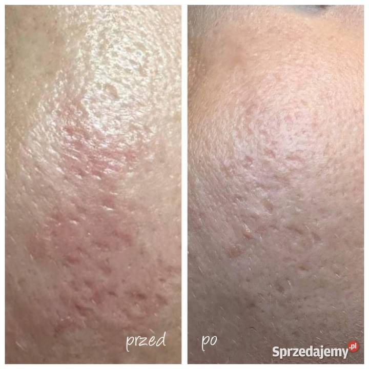 RF FRAKCYJNY Szczecin