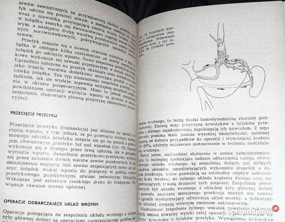 Nadciśnienie wrotne Jerzy Szczerbań miękka Chełm