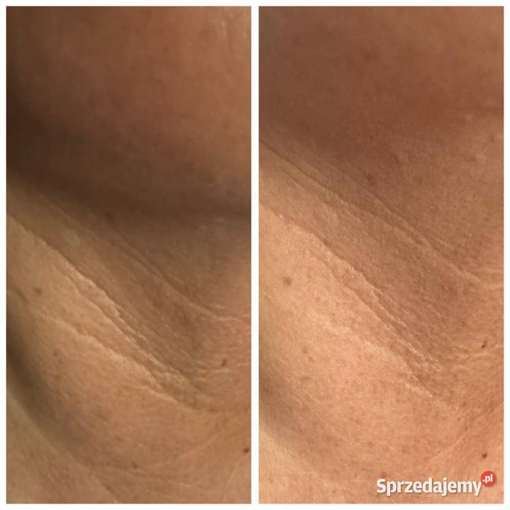 Rf Frakcyjny Szczecin sprzedam