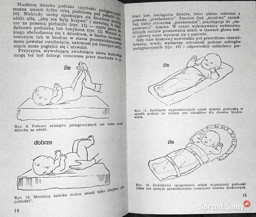 Wrodzone zwichnięcie biodra jest uleczalne Karol Chełm