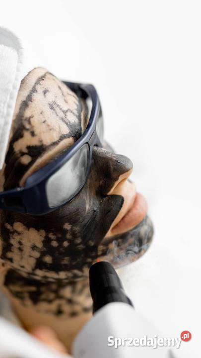 Peeling węglowy dogłębne oczyszczenie i Katowice