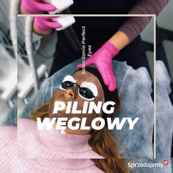 Piling Węglowy Pozostałe Bytom