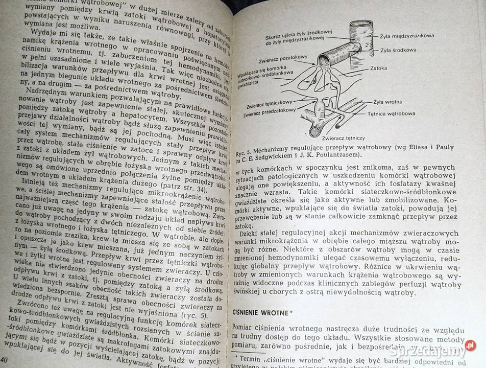 Nadciśnienie wrotne Jerzy Szczerbań Chełm