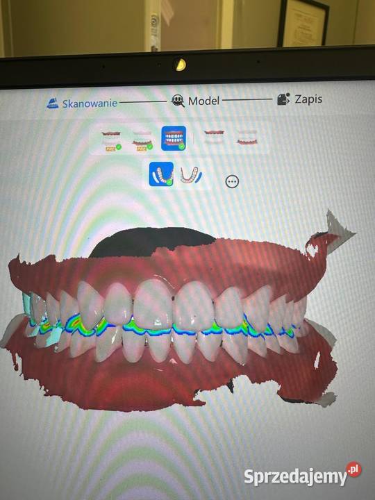 Skaner wewnątrzustyny Runyes 3DS dolnośląskie Wrocław