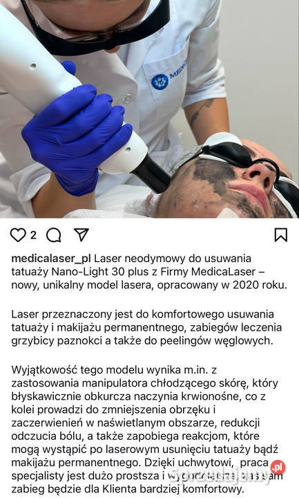 Laser do usuwania tatuażu Medicalaser Nano Light Pozostałe mazowieckie Warszawa sprzedam