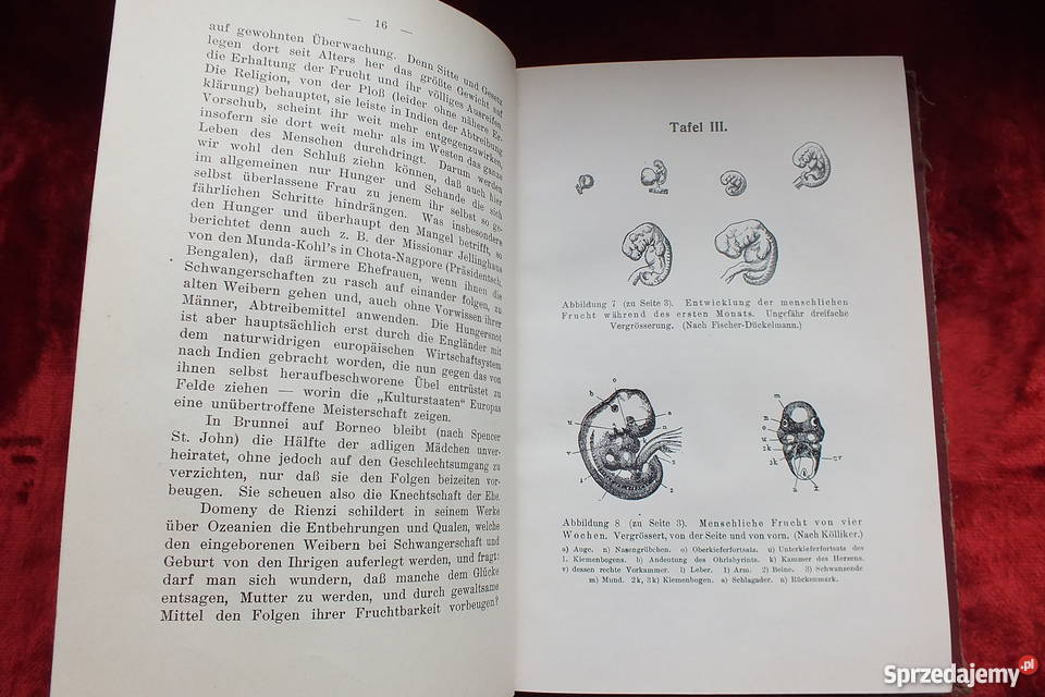 Stara książka Ginekologi Ein dunkler punkt 1907 lubuskie Żary