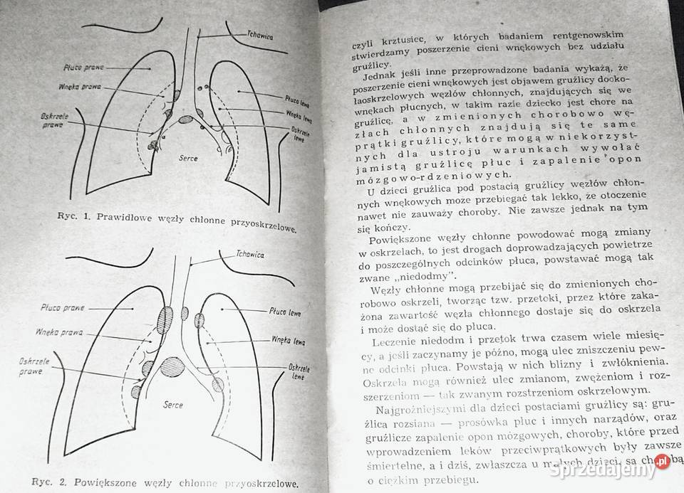 Odziecku zakażonym gruźlicą Anna Paszkowska Rok wydania 1965 lubelskie Chełm