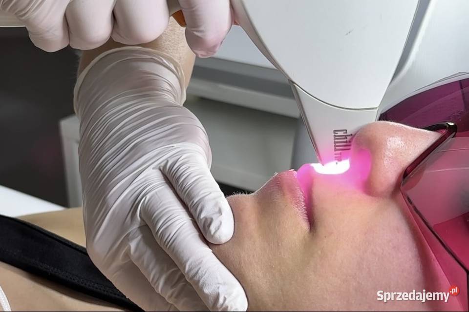 Depilacja laserowa Mosty Kosakowo Kosmetyczki pomorskie