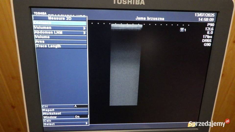 Aparat USG Ultrasonograf Toshiba Nemio MX stan Wyposażenie szpitali i gabinetów lubelskie