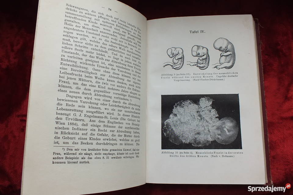 Stara książka Ginekologi Ein dunkler punkt 1907 lubuskie Żary