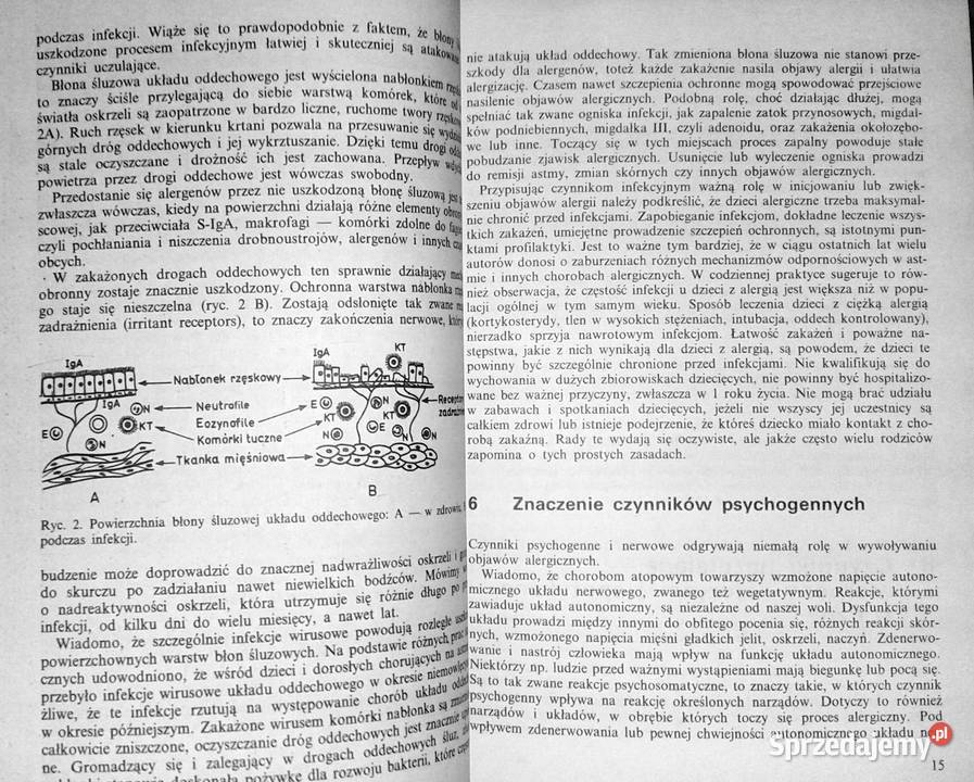 Alergia u dzieci Danuta ChmielewskaSzewczyk Chełm