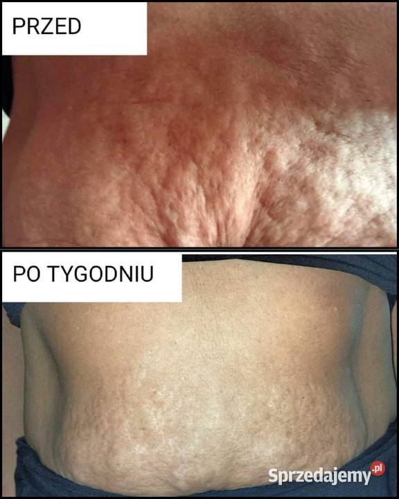 Termokrem ujędrniający Skuteczna pielęgnacja podlaskie Hajnówka