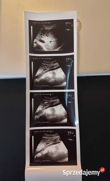 Zestaw USG ALOKA SSD500 Radom sprzedam