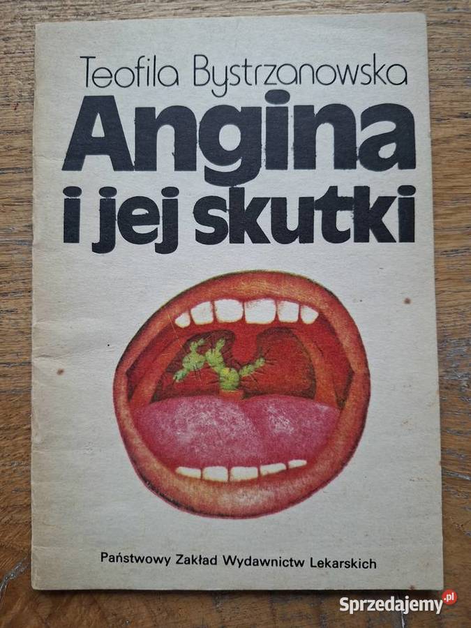Angina i jej skutki Teofila Bystrzanowska miękka Kraków