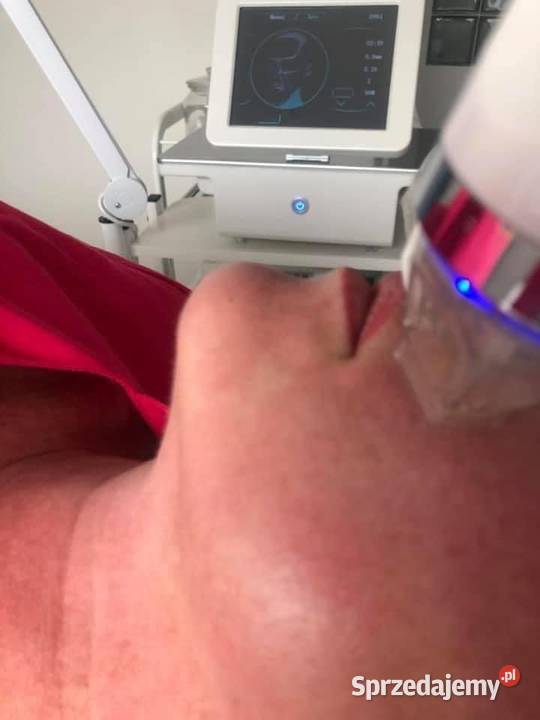 RF FRAKCYJNY Szczecin