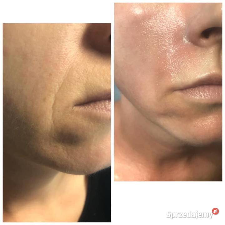 Rf Frakcyjny Szczecin sprzedam