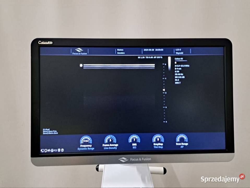 Aparat ultrasonograficzny FocusFusion Healthcare Pozostałe Słomczyn