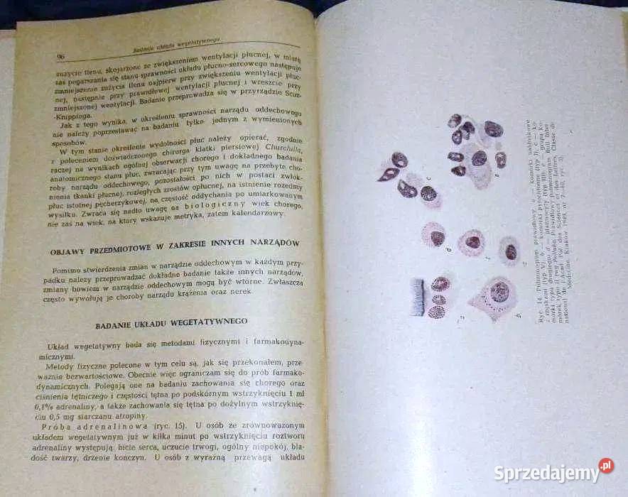 Nauka o chorobach wewnętrznych Tom 2 Witold E sprzedam