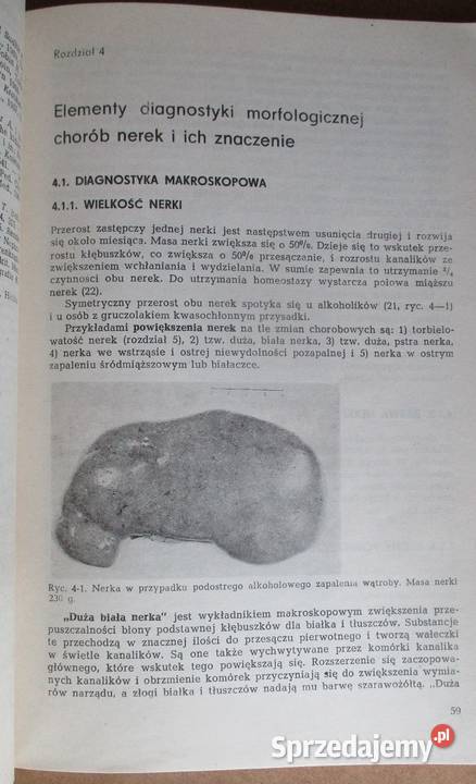 Patomorfologia nerek SKruś medycyna interna łódzkie